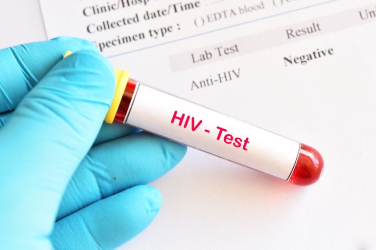 HIV Test in a Test Tube