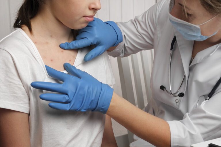 Doctor Checking Skin of Sick Girl. Kid with Red Rash being Examined at the Physician. Allergic Rash, Chicken pox, Monkeypox Symptoms on the Body of Child. Health Problem. Bacterial Infections, Disease